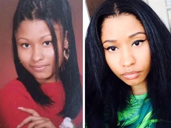 Nicki Minaj - before surgery and after plastic surgery